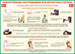 Таблица "Порядок действий при опасном кровотечении" (100х140 сантиметров, винил) - fgospostavki.ru - Москва